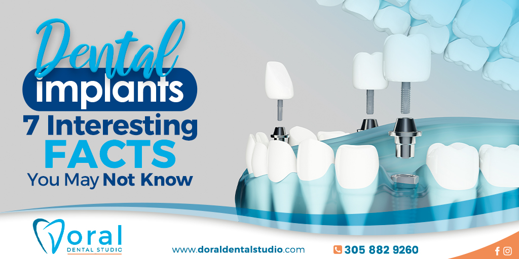 Dental Implants – 7 Interesting Facts You May Not Know