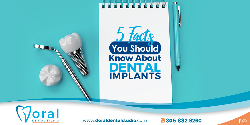 5 Facts You Should Know About Dental Implants