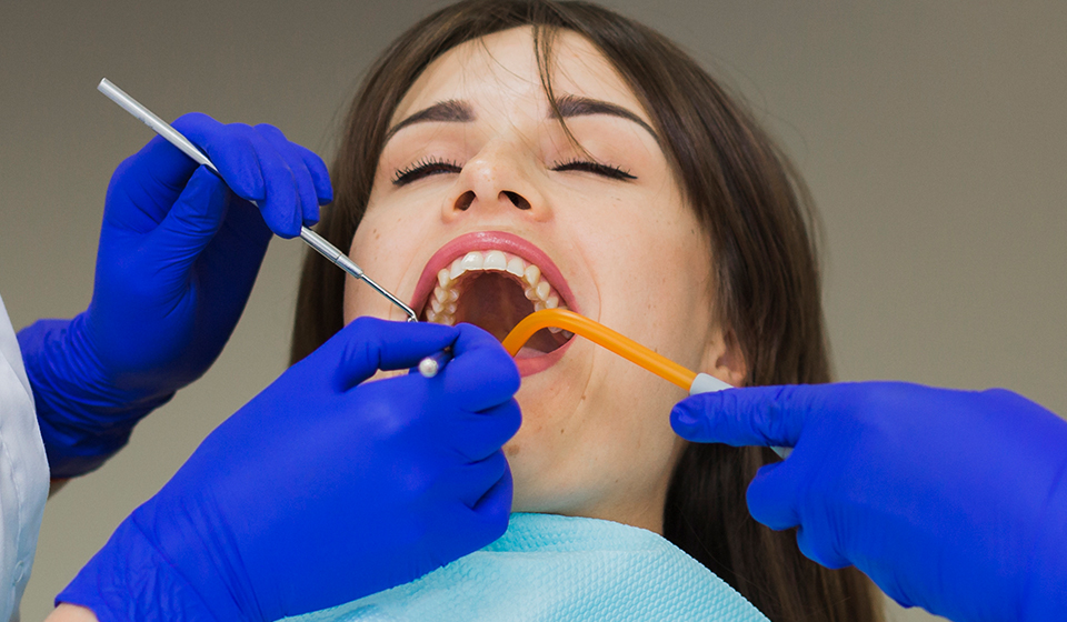 Frequently Asked Questions about Tooth Filling in Miami
