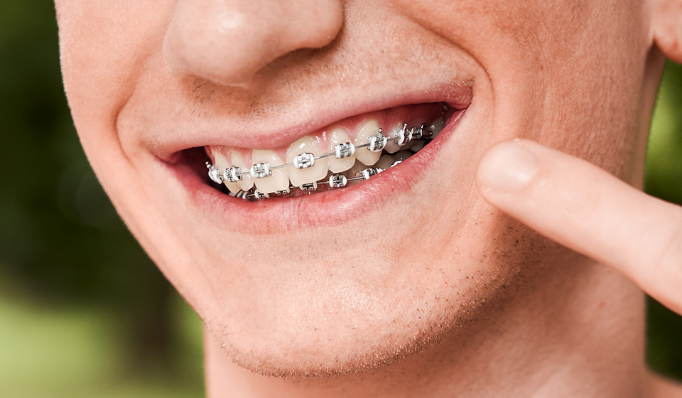 What to expect during your first orthodontic consultation